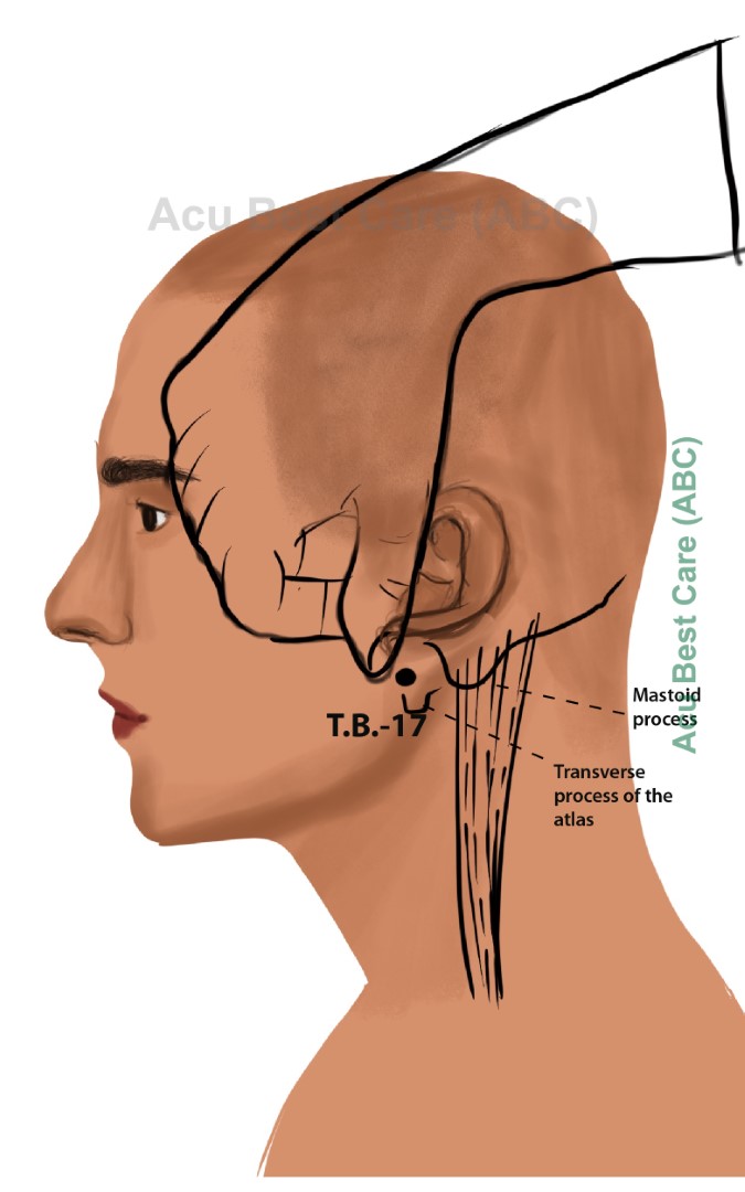 Acubestcare Meridian TW-17 or TB-17